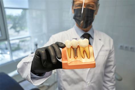 Dental Implant Experts in Fairfax, Virginia .
